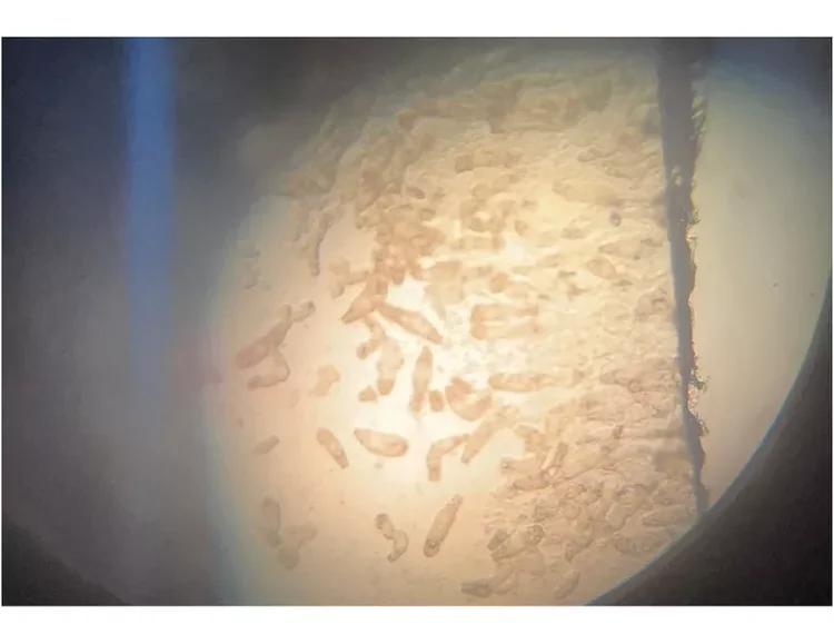 Gyrodactylus flukes under a microscope